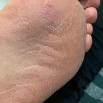 Adidas Ayakkabı Çok Sert