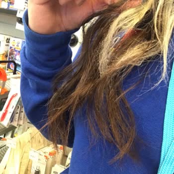 Sedat Akademi Business Saç Yanması