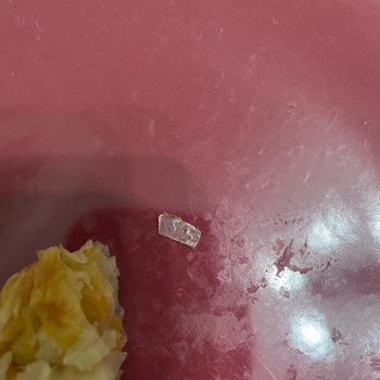 Superfresh Börekten Cam Gibi Parça Çıktı