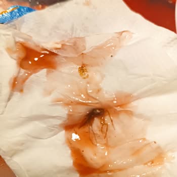 Hostam Piknik Döner Dönercide Ketçapta Böcek Çıktı!