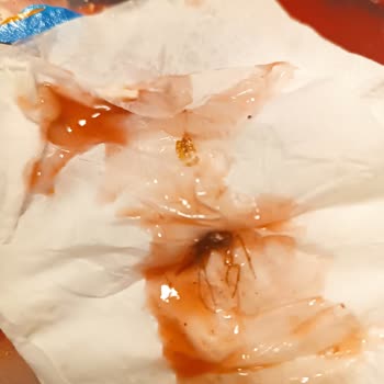 Hostam Piknik Döner Dönercide Ketçapta Böcek Çıktı!