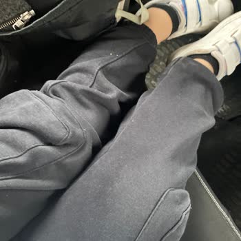 Zara Ürününün Kalitesizliği Ve