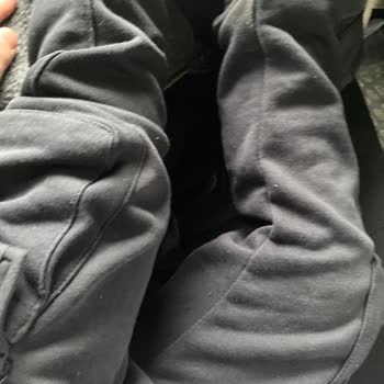 Zara Ürününün Kalitesizliği Ve