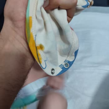 Prima Bebek Bezi Sızdırması