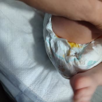 Prima Bebek Bezi Sızdırması