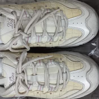 Skechers Ayakkabıda Sararma Renk Değiştirme