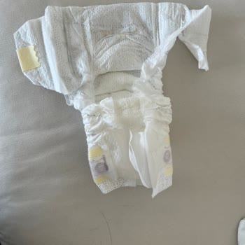 Prima Bebek Bezi Cırt Bandı Kopuk