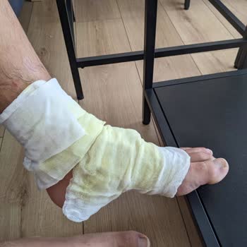 Homend Çay Makinesinin Tabanı Düştü, Derin Yanıklara Sebep Oldu