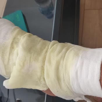 Homend Çay Makinesinin Tabanı Düştü, Derin Yanıklara Sebep Oldu