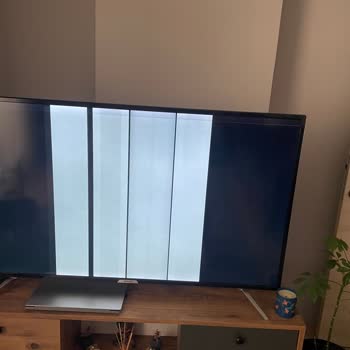 Onvo Televizyonum İçin Yasal Haklarım Verilmiyor