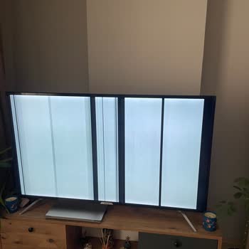 Onvo Televizyonum İçin Yasal Haklarım Verilmiyor