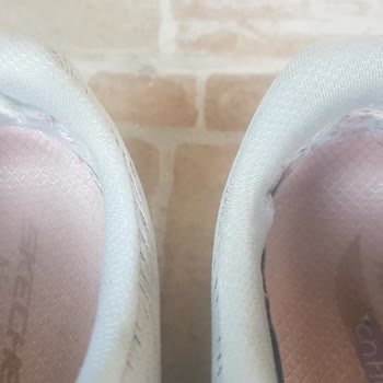 A101 Den Alınan Kadın Skechers Spor Ayakkabı İçinde Oluşan Deformasyon