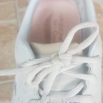 A101 Den Alınan Kadın Skechers Spor Ayakkabı İçinde Oluşan Deformasyon