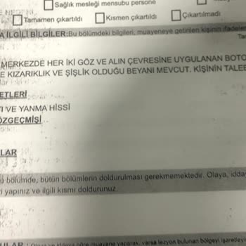 Zs Beauty Center'da Botoks İşlemi Sonrası Yaşadıklarım...