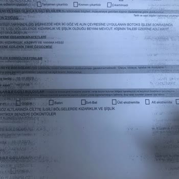 Zs Beauty Center'da Botoks İşlemi Sonrası Yaşadıklarım...