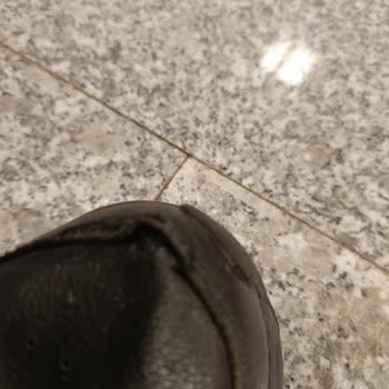 Skechers Ayakkabının Kalitesizliği İle Mağduriyet Yaşatması