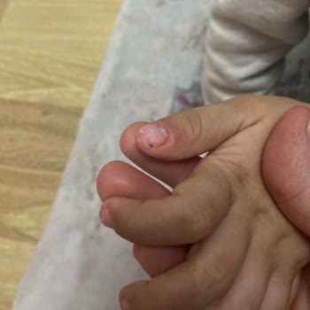 Gıpta Group Gıpta Oyun Hamuru Ele Yapışıyor Ve Kalıplardan Çıkmıyor