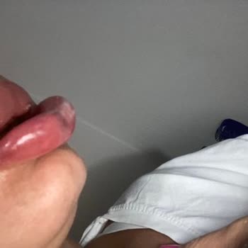 Sena Medikal Estetik Yüzümü Mahvettiler, Dudaklarımdan Oldum Ağzım Kaydı!