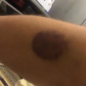 İstanbul Üniversitesi Tıp Fakültesi Çapa Kadın Doğum Şikayeti