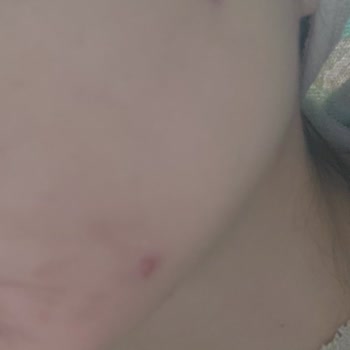 Yves Rocher Cilt Tonu Eşitlemek Yerine Sivilce Çıkaran Krem