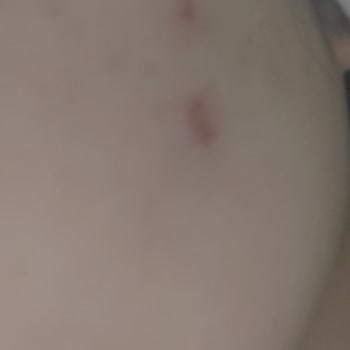 Yves Rocher Cilt Tonu Eşitlemek Yerine Sivilce Çıkaran Krem