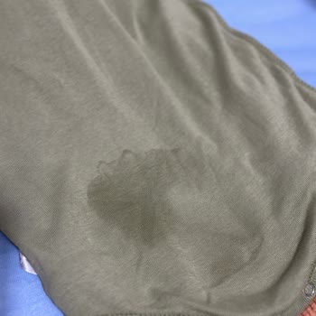 Molfix Bebek Bezinin Sızdırması