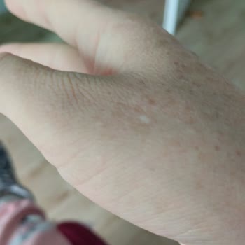 Sada Hastanesi Hasta Mağduriyeti Şikayeti