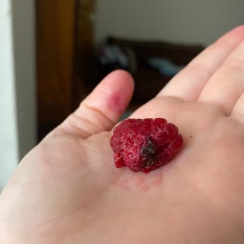 File Market Küflü Donmuş Meyve