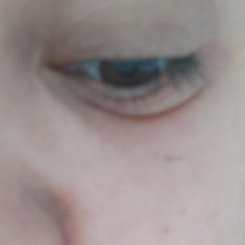 Golden Rose Kötü Ürün Gözlerim Şişti Ve Bulanık Gördüm