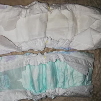 Molfix Bez Çok Çok Kötü