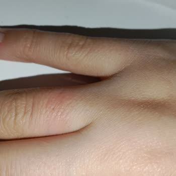 Pandora Mücevher Pandora Yüzük Soyulması Ve Değişim Kabul Edilmemesi.