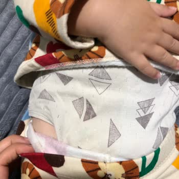 Baby Turco Bebek Bezi Sızdırıyor