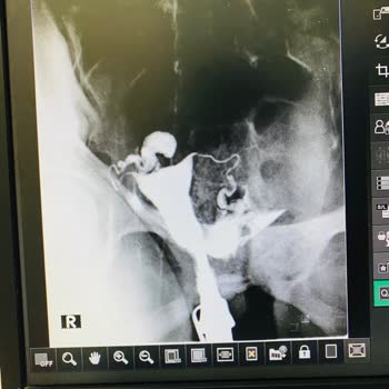 Özel Akdamar Hospital Yanlış Uygulanan Tedavi Hakkında