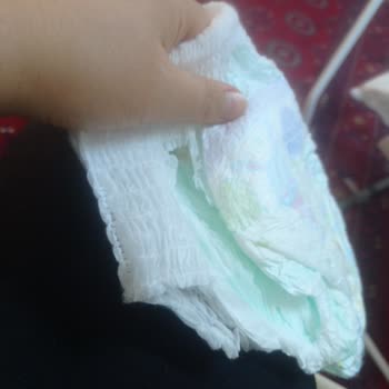 Molfix Bebek Bezi Şikayeti