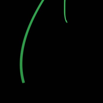 Vodafone İnternet Ve Hat Sorunu