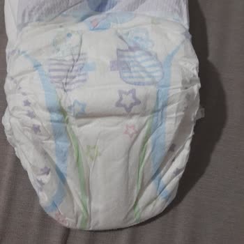 Molfix Bebek Bezi 6 Kalitesiz