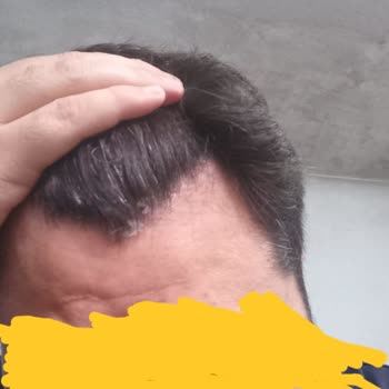 Vichy Kaşıntı Yara Kabuklanma