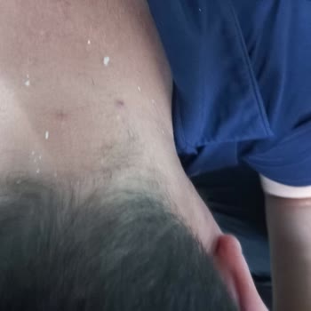 Vichy Kaşıntı Yara Kabuklanma