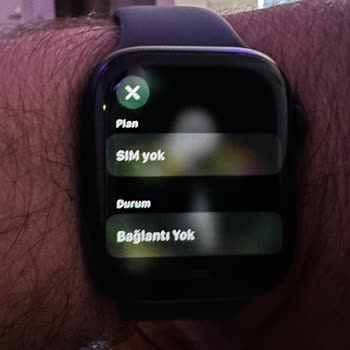 E-sim Apple Watch 9 Çalışmaması Ve Turkcell Beceriksizliği