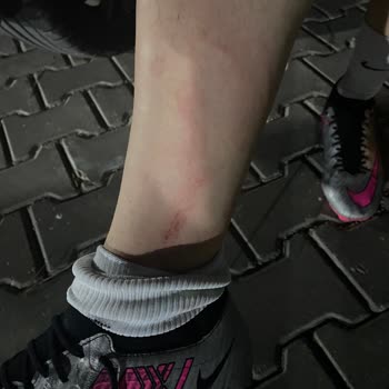 Hakem Verdiği Kararı Oyuncular Sayesinde Değiştirmesi