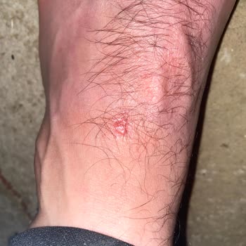 Hakem Verdiği Kararı Oyuncular Sayesinde Değiştirmesi