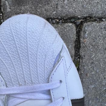 adidas Daha 1 Haftalık Ayakkabı Yırtıldı Böyle Bir Şey Yok Ya