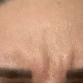 Eki aç