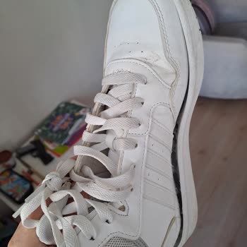 Ankara Deichmann Mağazasından Adidas Ayakkabının 2 Ayda Yırtılması