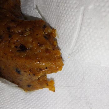 Ziraat Bankası Hesabımdan Para Çekmiş