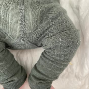 H&M Esnedi Ve Tüylendi