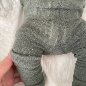 H&M Esnedi Ve Tüylendi