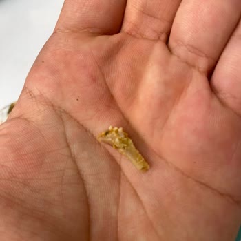 Ekrem Coşkun Döner Tavuk Dönerde Kemik