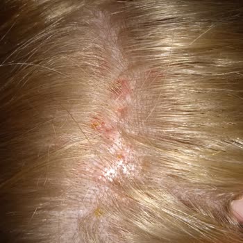 Menekşe Bay & Bayan Kuaför Vücudumda Ciddi Yaralar Oluşturma