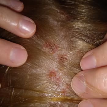 Menekşe Bay & Bayan Kuaför Vücudumda Ciddi Yaralar Oluşturma